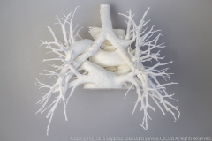pulmonary_vascularity_bronchus_3dprint_model_01