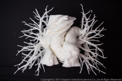 pulmonary_vascularity_bronchus_3dprint_model_05