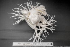 pulmonary_vascularity_bronchus_3dprint_model_10