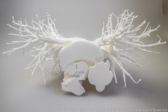 pulmonary_vascularity_bronchus_3dprint_model_02