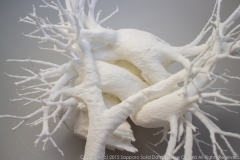 pulmonary_vascularity_bronchus_3dprint_model_03
