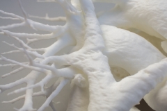 pulmonary_vascularity_bronchus_3dprint_model_04