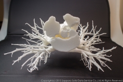 pulmonary_vascularity_bronchus_3dprint_model_06