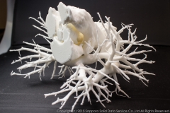 pulmonary_vascularity_bronchus_3dprint_model_07