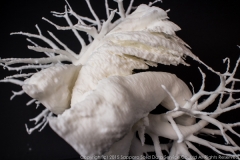 pulmonary_vascularity_bronchus_3dprint_model_08
