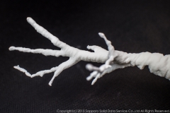 pulmonary_vascularity_bronchus_3dprint_model_12