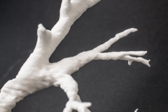 pulmonary_vascularity_bronchus_3dprint_model_13