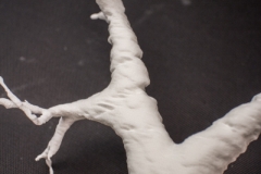 pulmonary_vascularity_bronchus_3dprint_model_14
