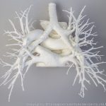 pulmonary_vascularity_bronchus_3dprint_model_01