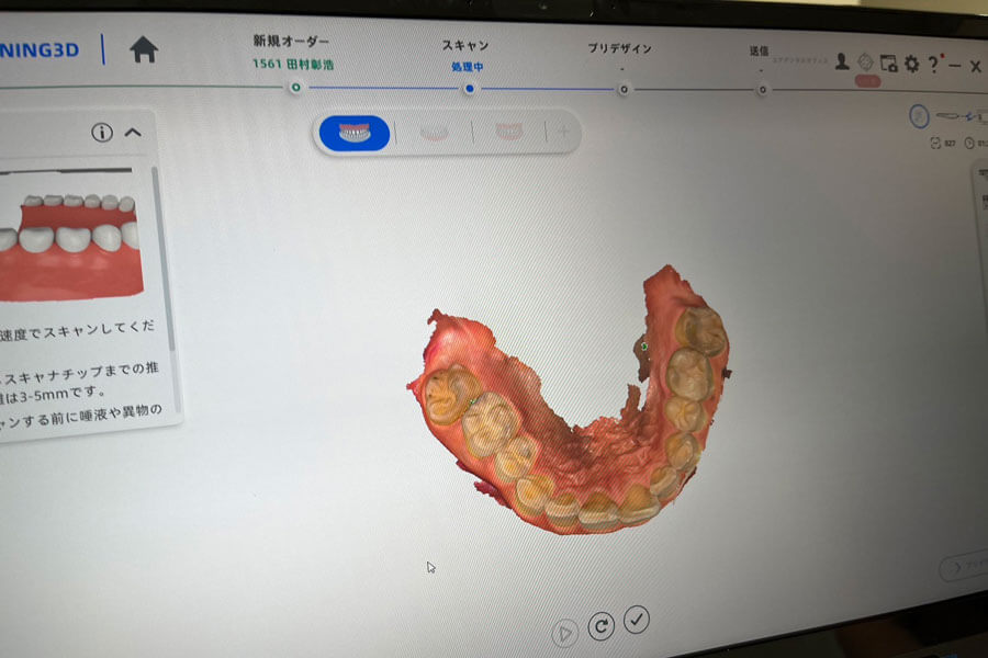 dental_3d_scan_03