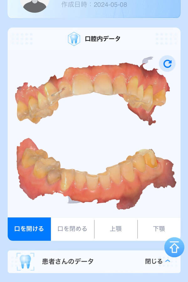 dental_3d_scan_06