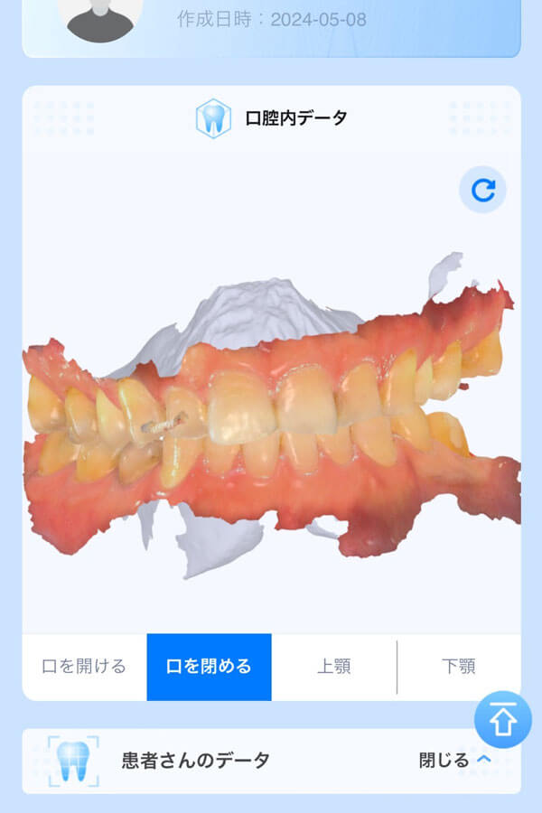 dental_3d_scan_07