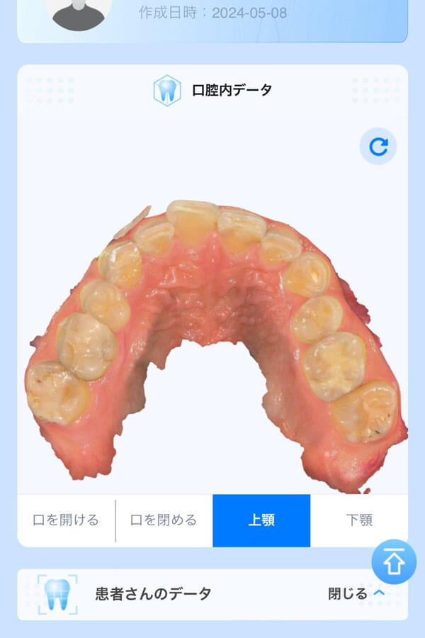 dental_3d_scan_08