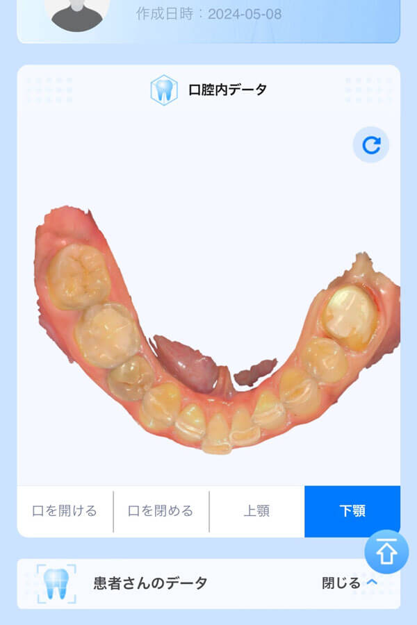 dental_3d_scan_09