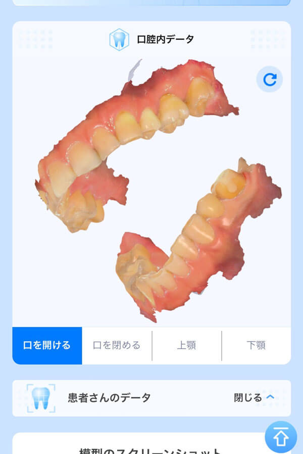 dental_3d_scan_10